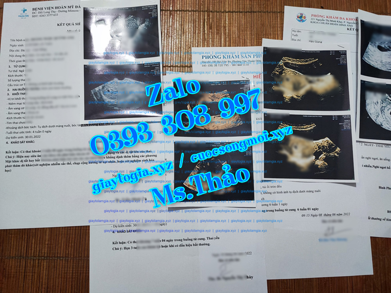 Hình ảnh giấy siêu âm thai 2 tuần